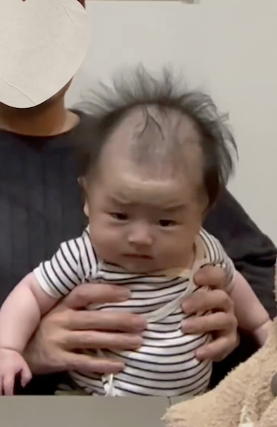 髪が薄く見える赤ちゃん