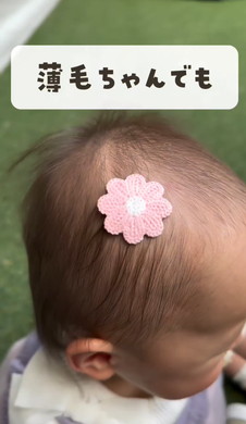 薄毛の赤ちゃんに朗報