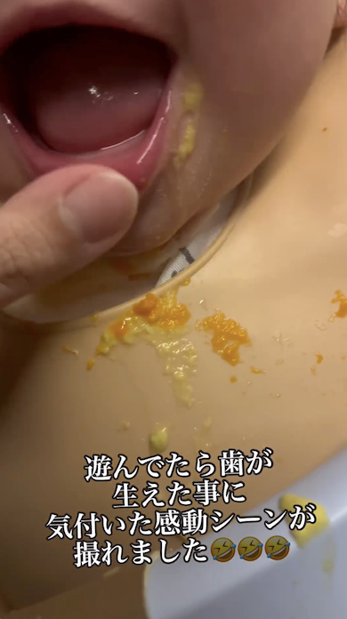 歯が生えていることの確認