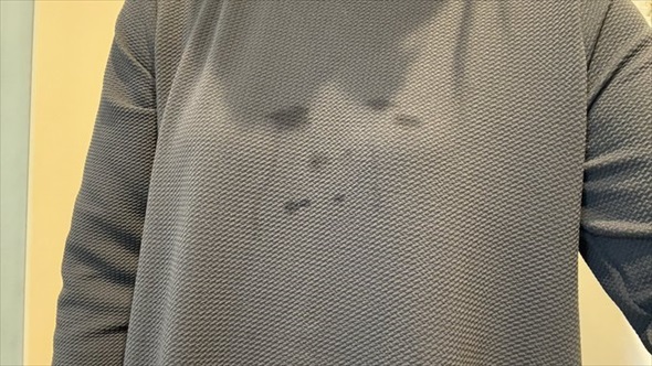 わたしの服に転写されたむすめのかなしみ