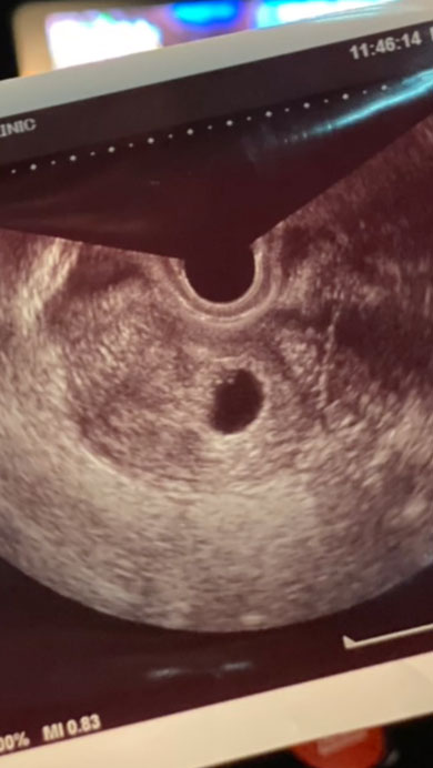 妊娠報告で号泣するパパ