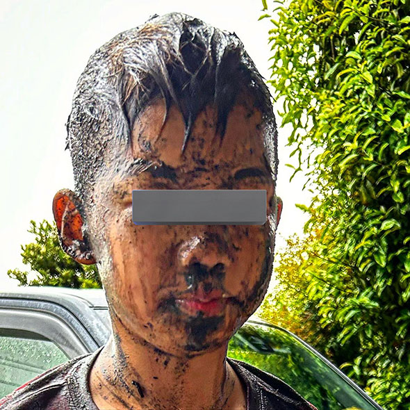 自転車で田んぼに落ちた男の子