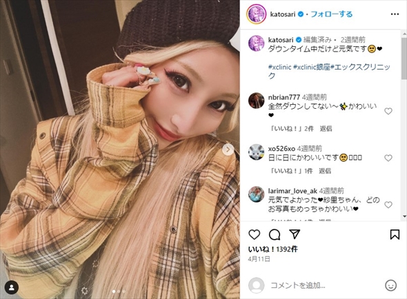 全身脂肪吸引を受けた加藤紗里