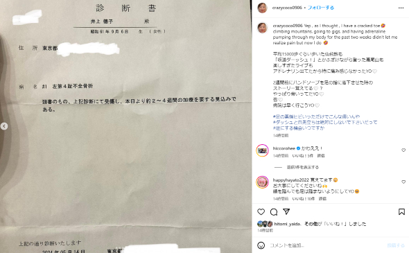 足の薬指が骨折したことを明かしたCRAZY COCO