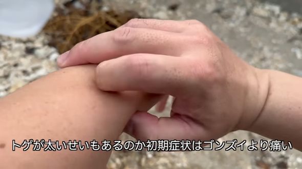 「ウンコ食い」ことクロホシマンジュウダイを刺した感想はゴンズイより痛い