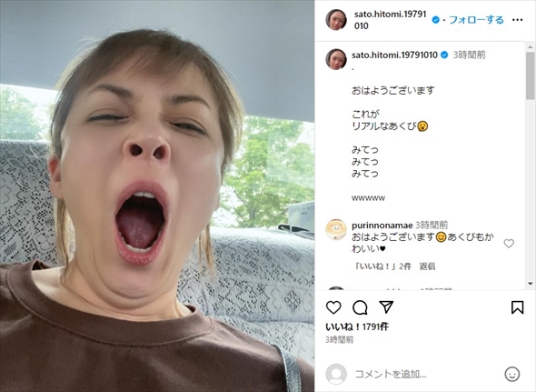 佐藤仁美のリアルなあくび写真