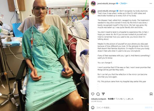 HLHを克服したパワーリフターのジャレッド・メイナードが大会に復帰