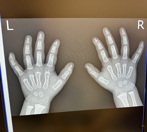 レントゲン 整形外科 骨格