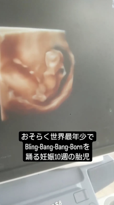 胎児のブリンバンバン