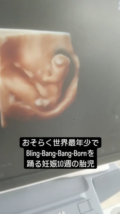 胎児のブリンバンバン