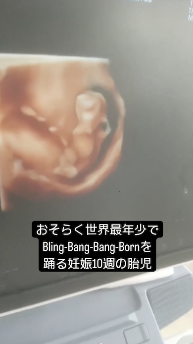 胎児のブリンバンバン