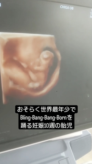 胎児のブリンバンバン
