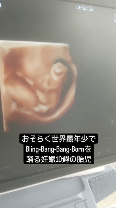 胎児のブリンバンバン
