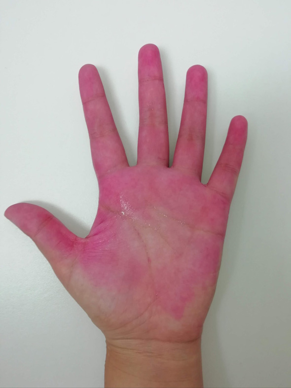 ドラゴンフルーツ 切るとき 白い服 色 落ちない 赤い色素 果汁