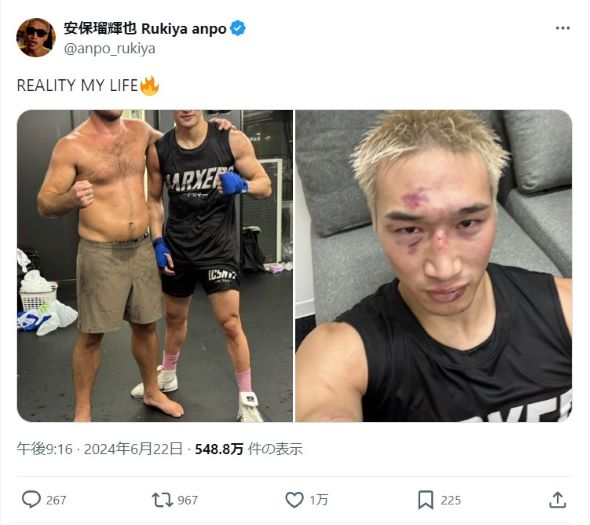 チャンピオンとの試合についての安保瑠輝也のポスト