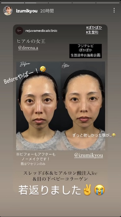 和泉杏Instagram