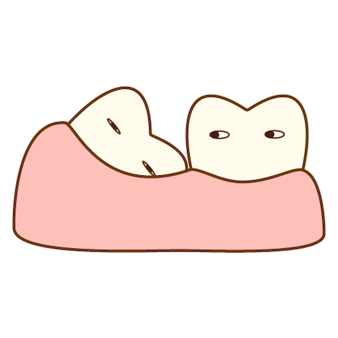 親知らずイラスト