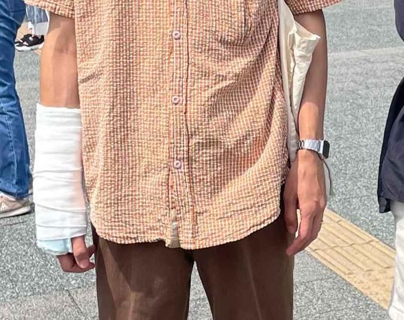 ケガをした右腕