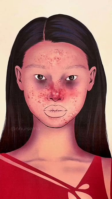 イラストを韓国美女にメイク・ビフォー