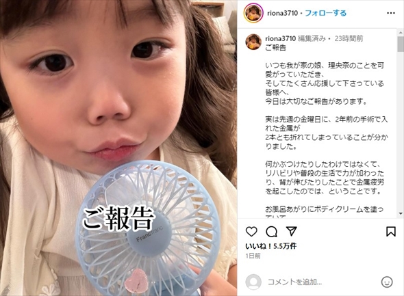 先天性疾患を持つ人気YouTubeのりおなちゃん