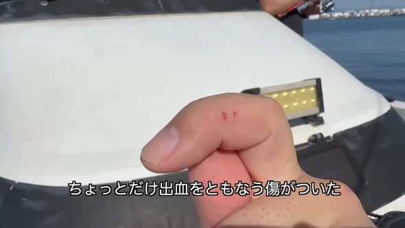 クロダイやキチヌにかまれて出血した指