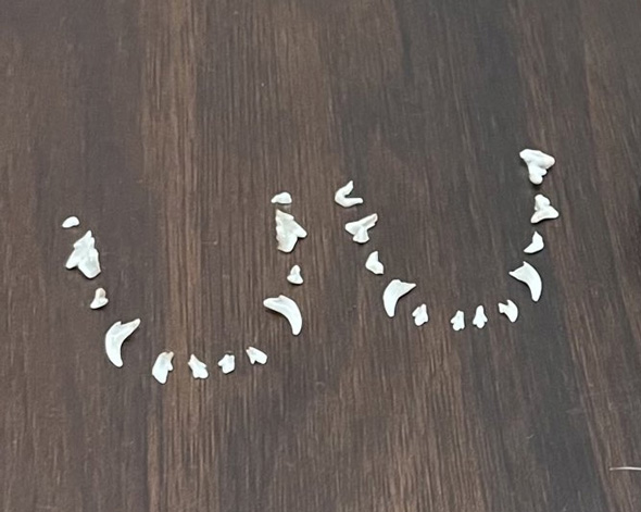 乳歯トリミング