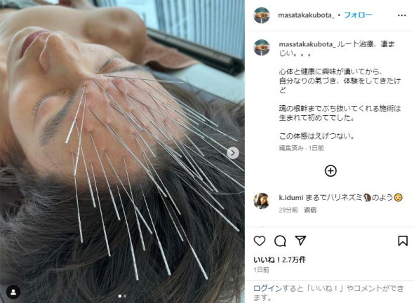 窪田正孝 ルート治療