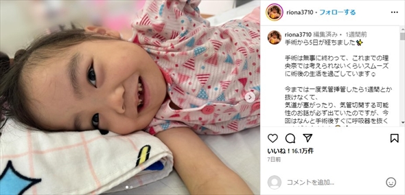 先天性疾患を持つ人気YouTubeのりおなちゃん