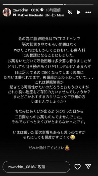 ざわちんのストーリーズ