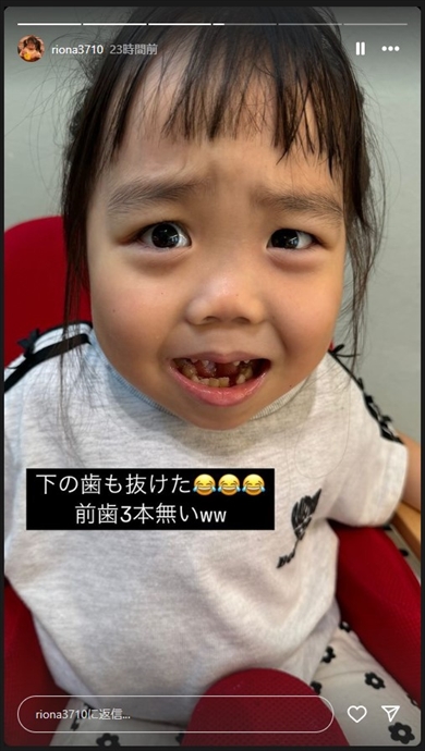 先天性疾患を持つ人気YouTubeのりおなちゃん