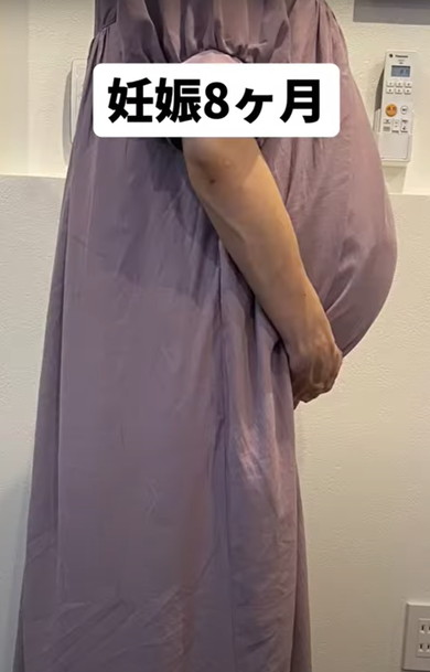 双子出産したママのお腹