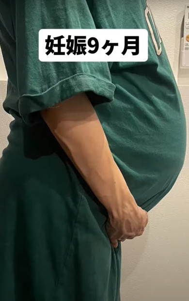 双子出産したママのお腹