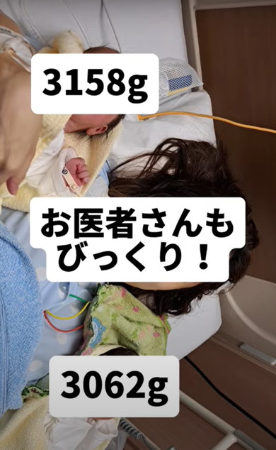 双子出産したママのお腹