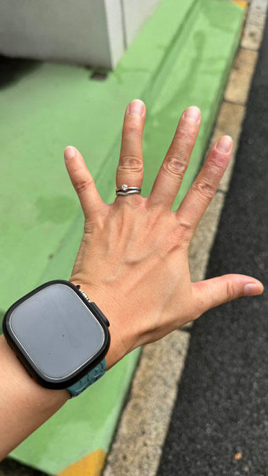 取れなくなった指輪