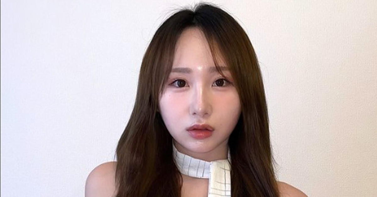 そんな事故がありました」元AKBメンバー、在籍中の美容施術を告白 ボトックスで表情が動かなくなる「失敗でした」（1/2） | ねとらぼ