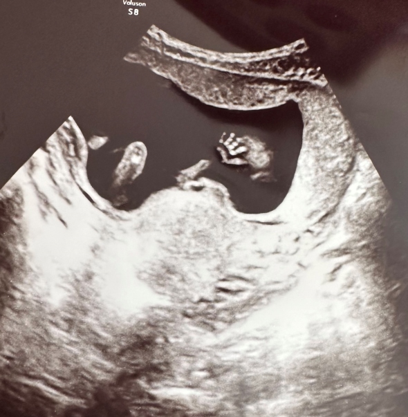 赤ちゃんのおてて