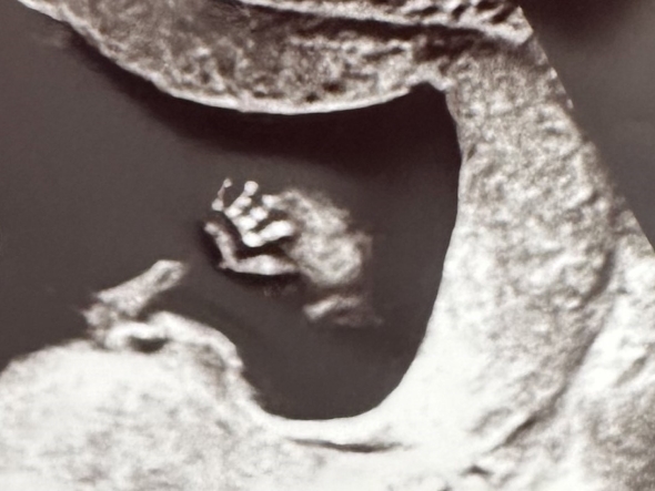 赤ちゃんのおてて