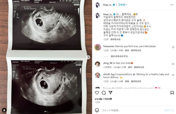 マンモグラフィに映ったヘインさんの第二子