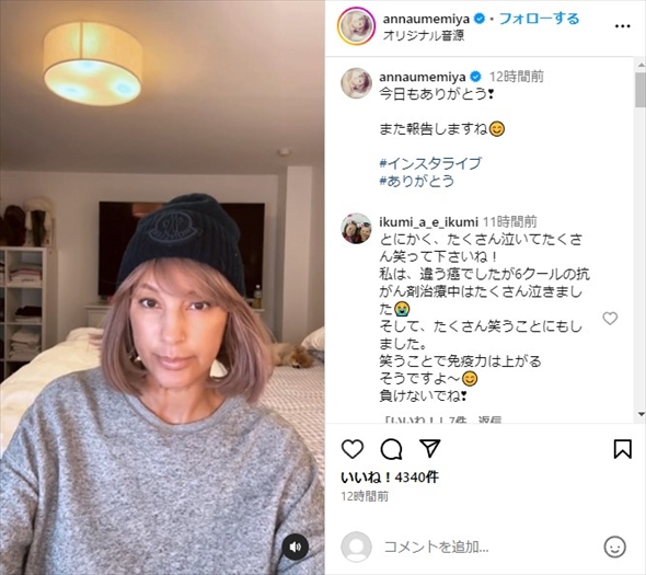 オーダーメイドの医療用ウィッグを装着した梅宮アンナ