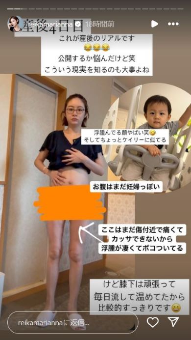 出産直後の宮崎さん