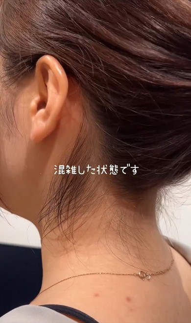 うなじをM字に剃っていく