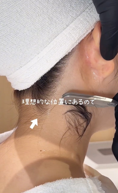 うなじをM字に剃っていく