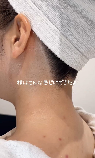 うなじをM字に剃っていく