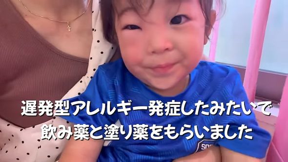 顔が腫れたものの元気よく母と一緒に病院へ向かい薬を処方してもらった息子
