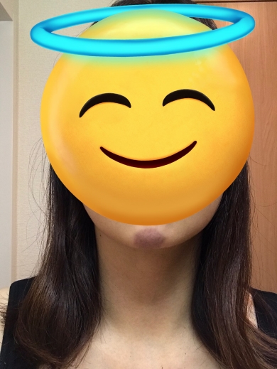 ペットボトルの水圧でついた跡