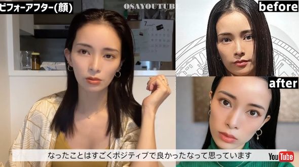 顔のビフォーアフター