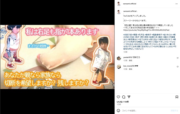 右足指が1本残っていた佐野有美