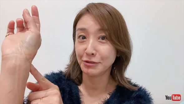 揚げ物中の事故で顔と腕に大やけどを負った高橋里華