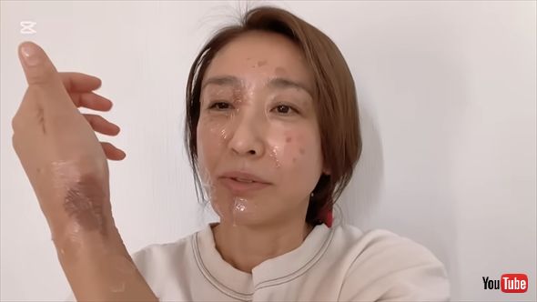 揚げ物中の事故で顔と腕に大やけどを負った高橋里華