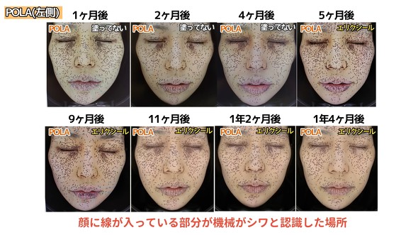 ポーラ　リンクルクリーム2本 人気のリンクルクリーム2種を1年塗り続けたら…… とんでもない